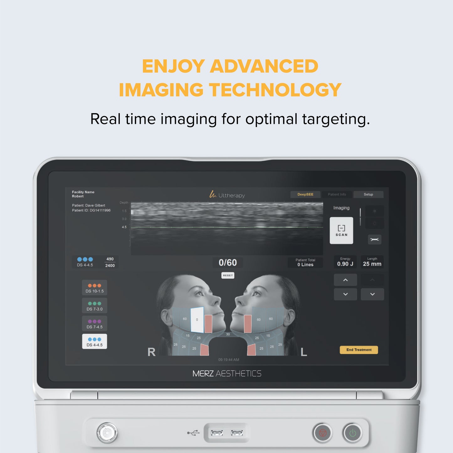 Ultherapy PRIME Deposit (*T&C applies)