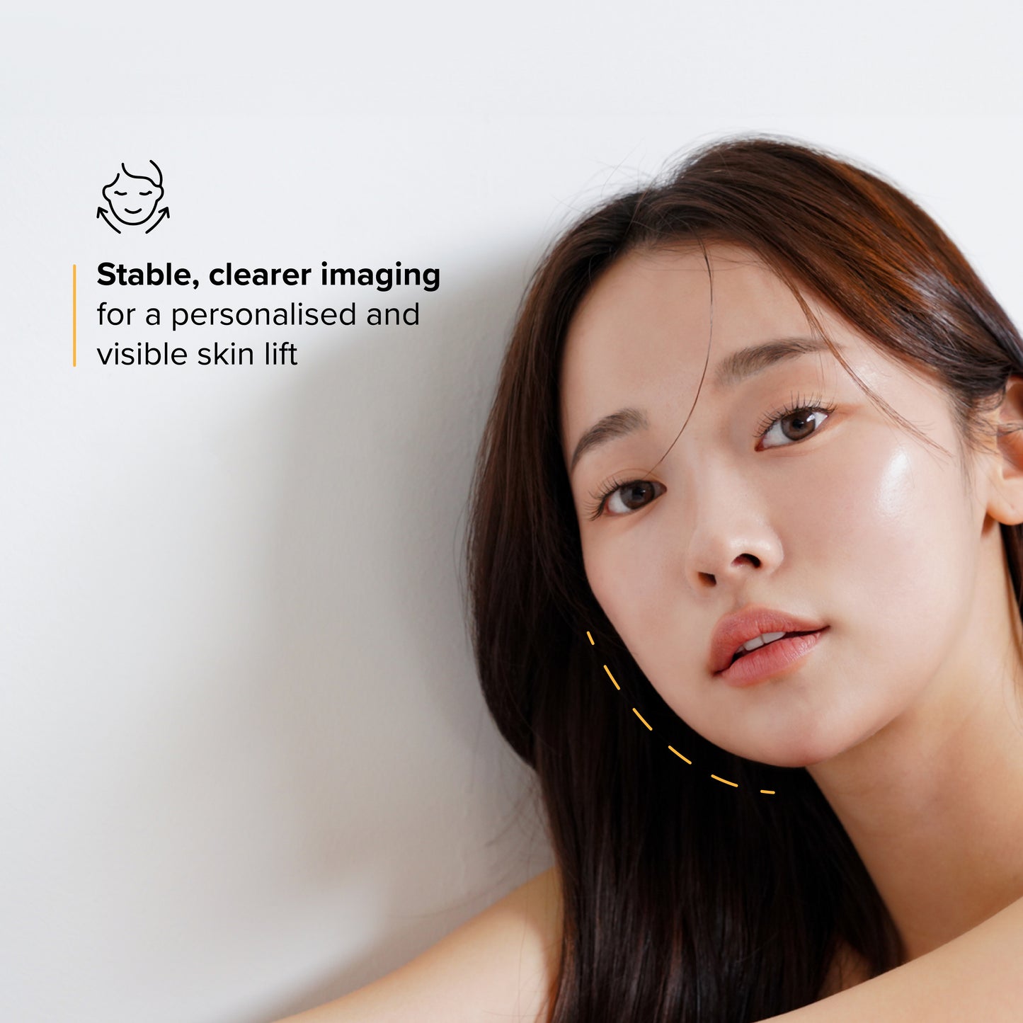 Ultherapy PRIME Deposit (*T&C applies)