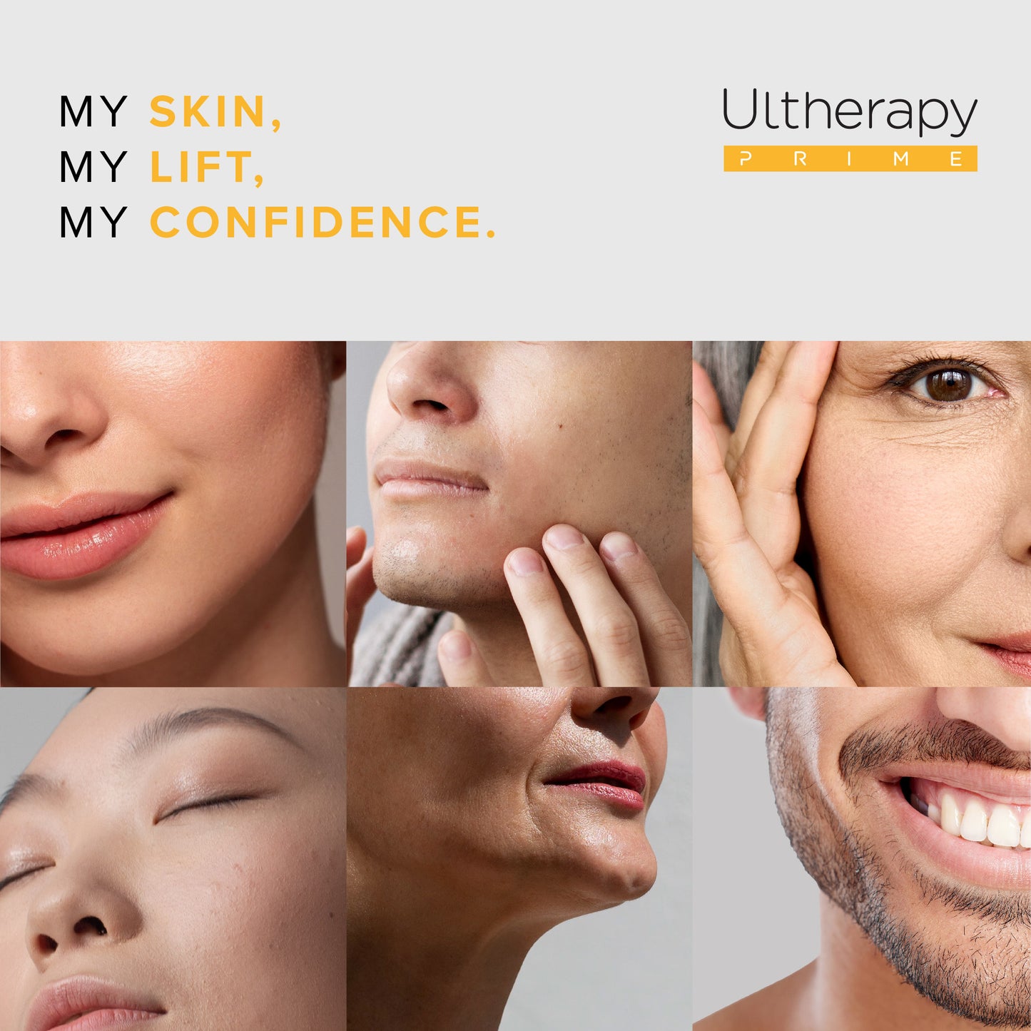 Ultherapy PRIME Deposit (*T&C applies)