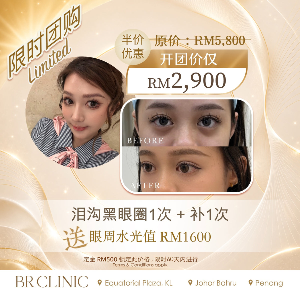 Beautrice 十月开团:- Under-Eye Revival Treatment (T&C applies)