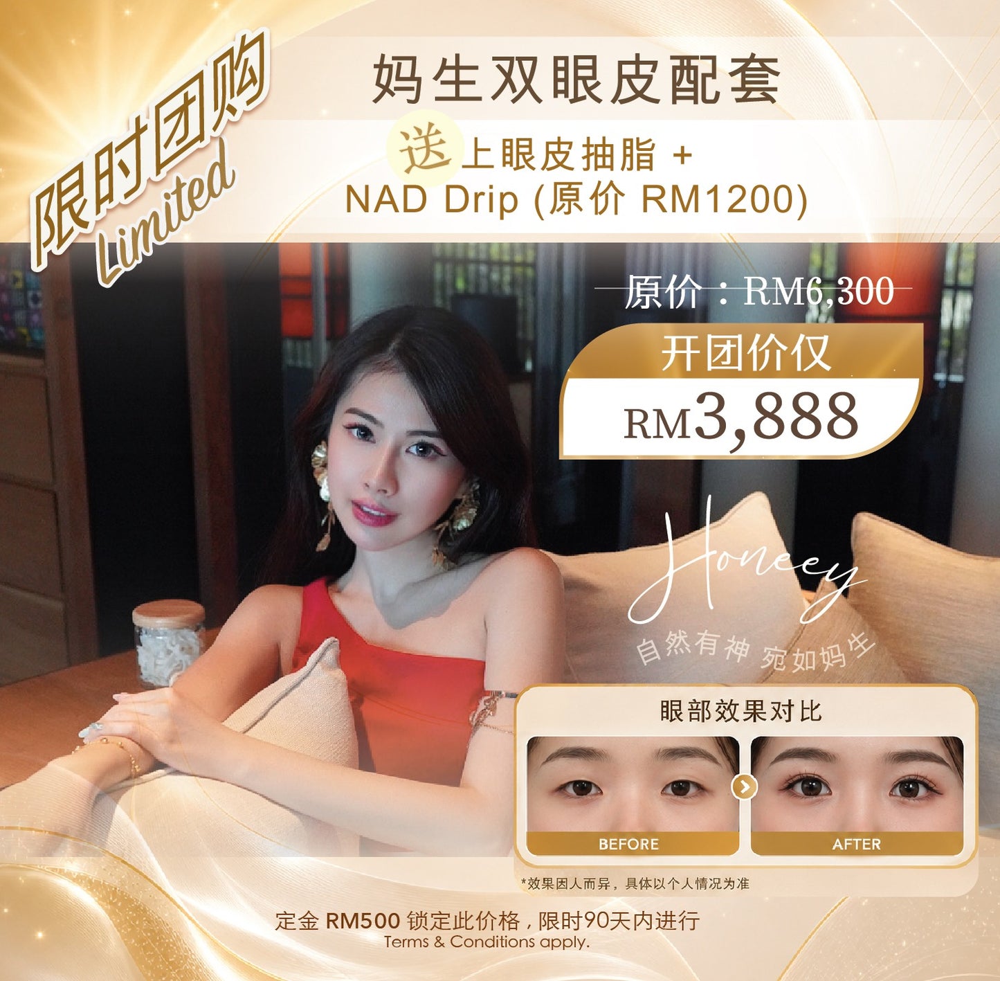 Honeey 首次独家开团:- Upper Eye Treatment Bundle (T&C applies)