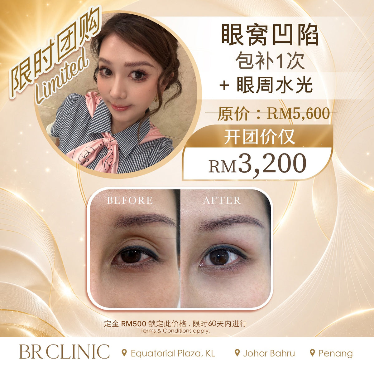 Beautrice 十月开团:- PLUS* Sunken Eye Revival Treatment (T&C applies)