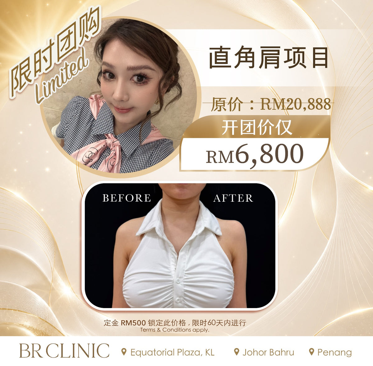 Beautrice 十月开团:- Shoulder Contour Treatment (T&C applies)