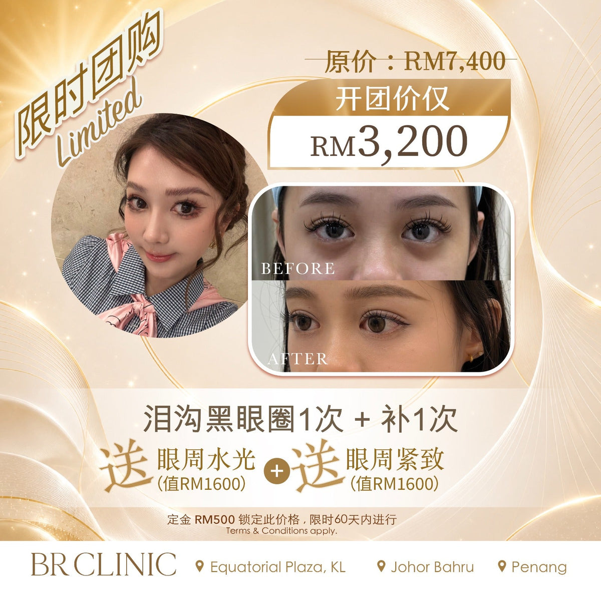 Beautrice 十月开团