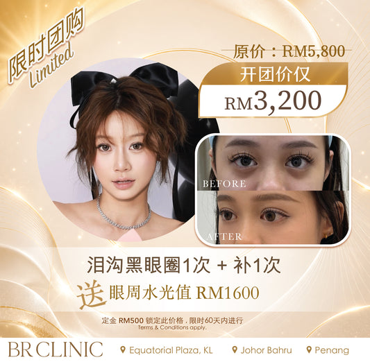 Quennie 八月开团:- Tear Trough & Dark Circle (T&Cs apply)