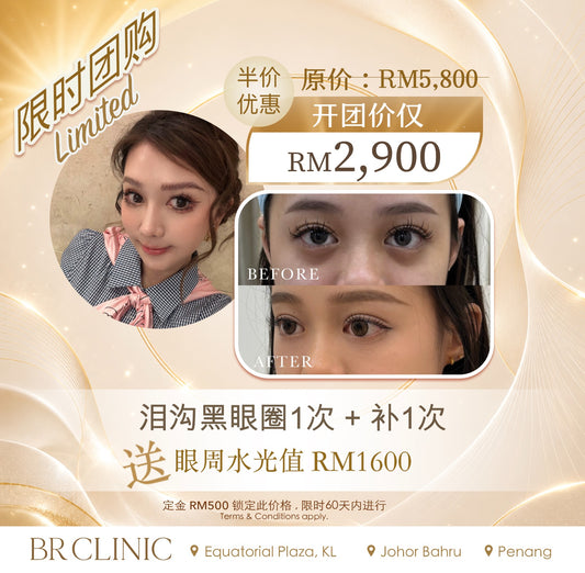 Beautrice 十月开团:- Under-Eye Revival Treatment (T&C applies)