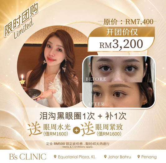Siaw Jie 独家开团:- PLUS* Under-Eye Revival Treatment (T&C applies)