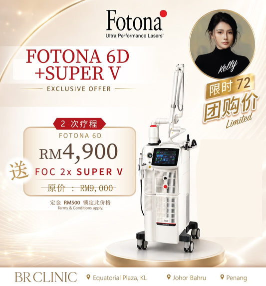 Kelly Goh 独家开团:- Fotona 6D+ Super V (T&Cs apply)