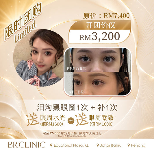 Beautrice 十月开团:- PLUS* Under-Eye Revival Treatment (T&C applies)