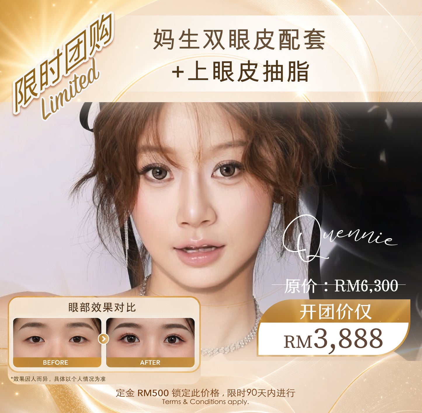 Quennie 八月开团:- Upper Eye Treatment Bundle (T&Cs apply)