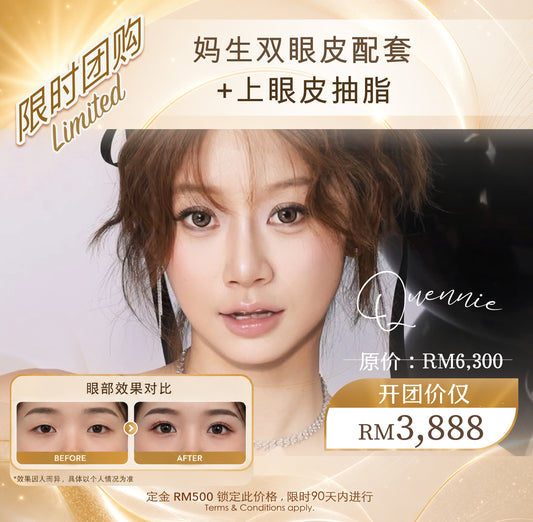 Quennie 八月开团:- Upper Eye Treatment Bundle (T&Cs apply)