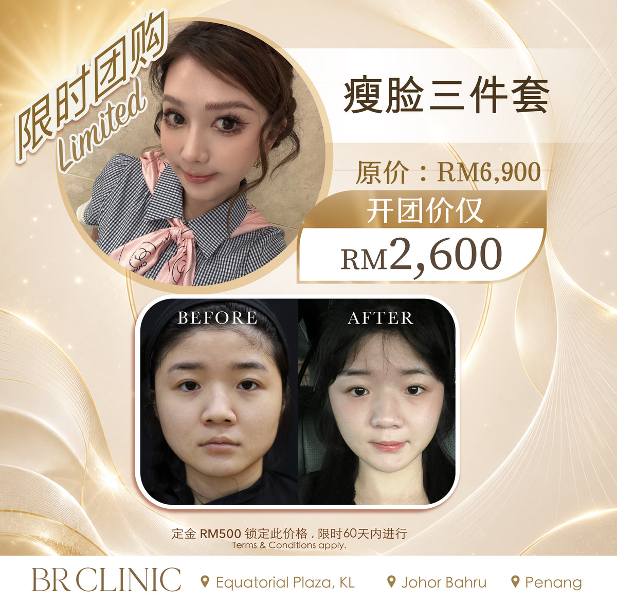 Beautrice 十月开团: 3-in-1 V-Face Contouring (T&C applies)